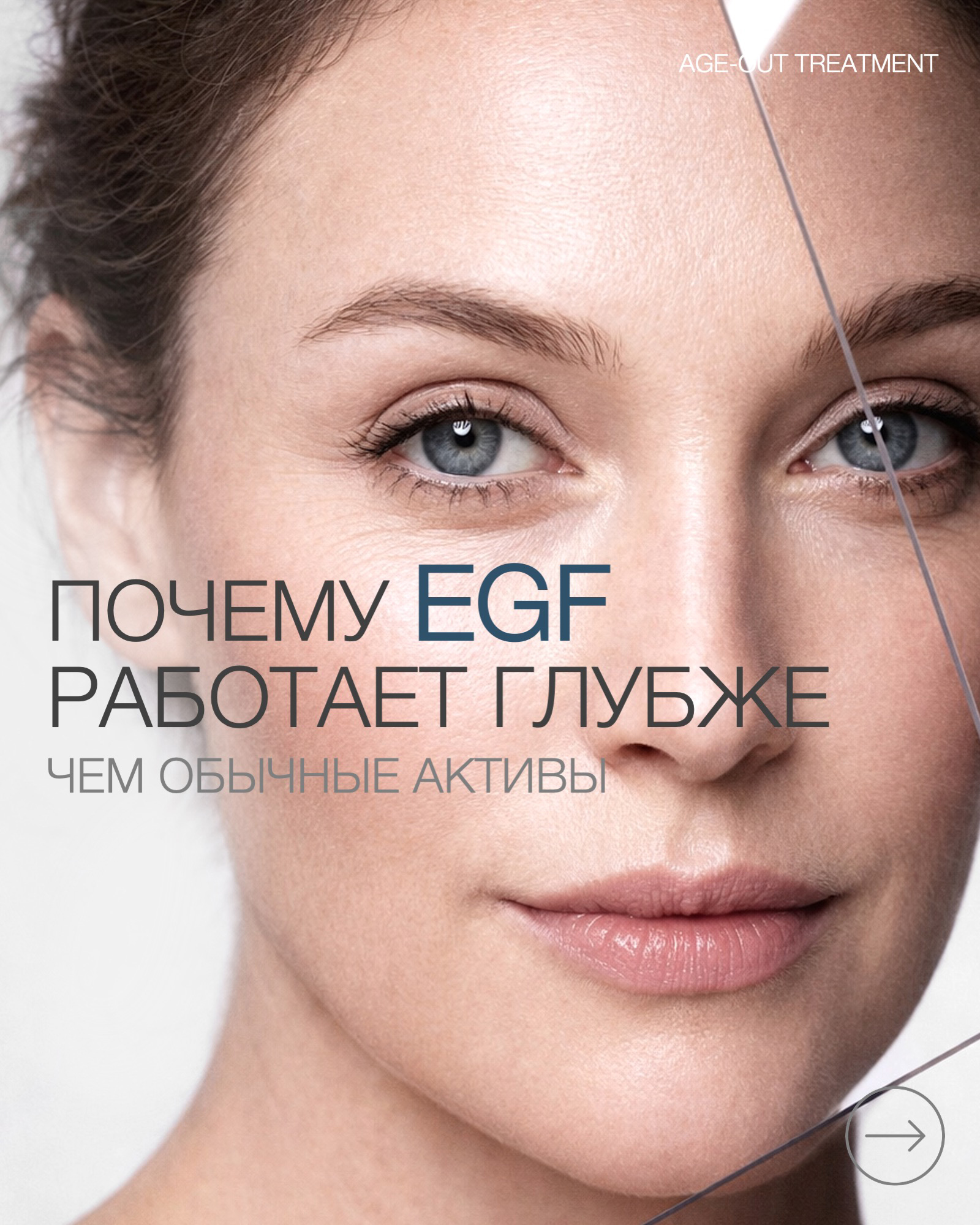 Пост EGF 26 2.jpg